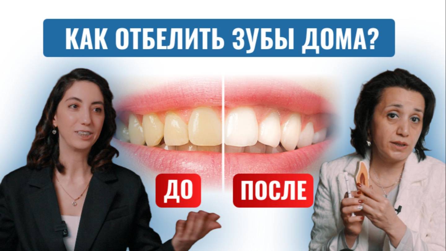 Как отбелить зубы дома? В чём отличие домашнего отбеливания от отбеливания в клиники?