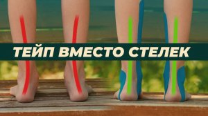Тейп вместо стелек. Поддержка стопы в открытой обуви для детей и взрослых.