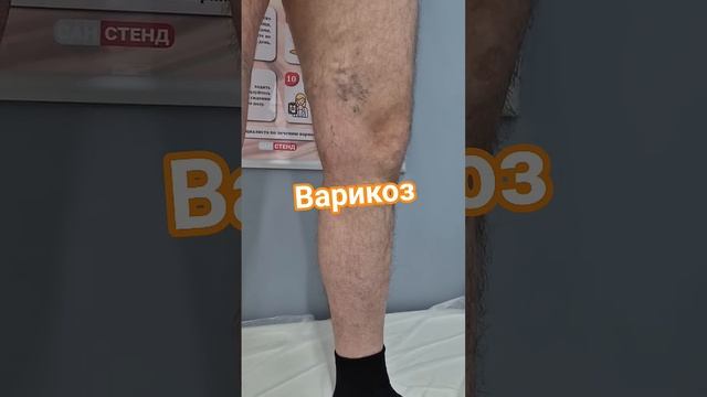 Вот почему надо носить компрессионный трикотаж.