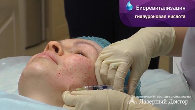 Биоревитализация, биорепарация, редермализация. Сходства, отличия, показания.