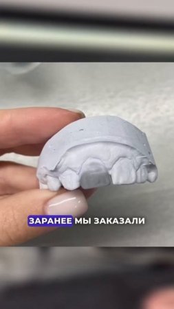 Он упал с самоката?! ❤️ Стоматология “СТОЛИЦА”  Москва, ЦАО. Круглосуточно!