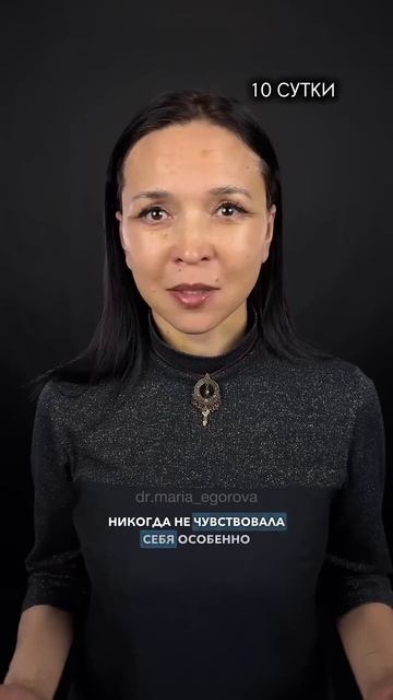 Я хочу быть красивой! 10 сутки и 2 месяца после фейслифт? смотреть онлайн