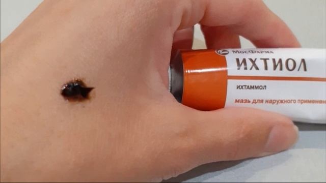 НЕВЕРОЯТНО Вы только посмотрите! Ихтиоловая мазь в 7 р