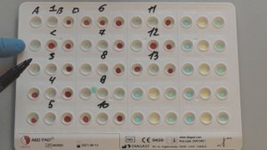 009. Определение группы крови на планшете ABD PAD. 2021.06.21. 1080p.