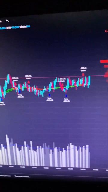 БИНАРНЫЕ ОПЦИОНЫ ЭТО СКАМ !? #shorts #бинарныеопционы #фор?