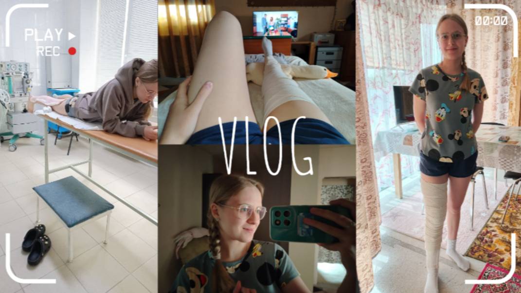 VLOG ГИПС?🩹 2 недели дома😞