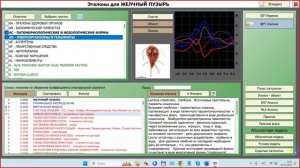 2024-07-30_131145-ПО Дианел®-2.1. обучение, Работа с эталонами, анализ вероятности процессов,примеры
