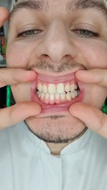 Lacalut + Biomed😉 смотреть онлайн