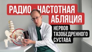 РЧД тазобедренного сустава - эффективный метод контроля боли при терминальном коксартрозе
