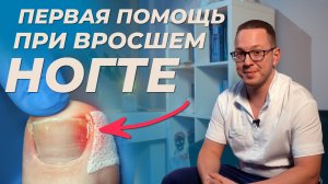 Как мгновенно убрать боль при ВРОСШЕМ НОГТЕ самостоятельно