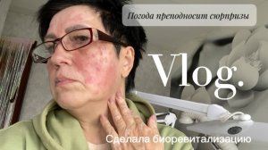 VLOG Погода нас испытывает на прочность ❄️ Сделала биоретализацию 🧑🏻