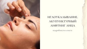 Иглоукалывание для лица. Акупунктурный лифтинг лица