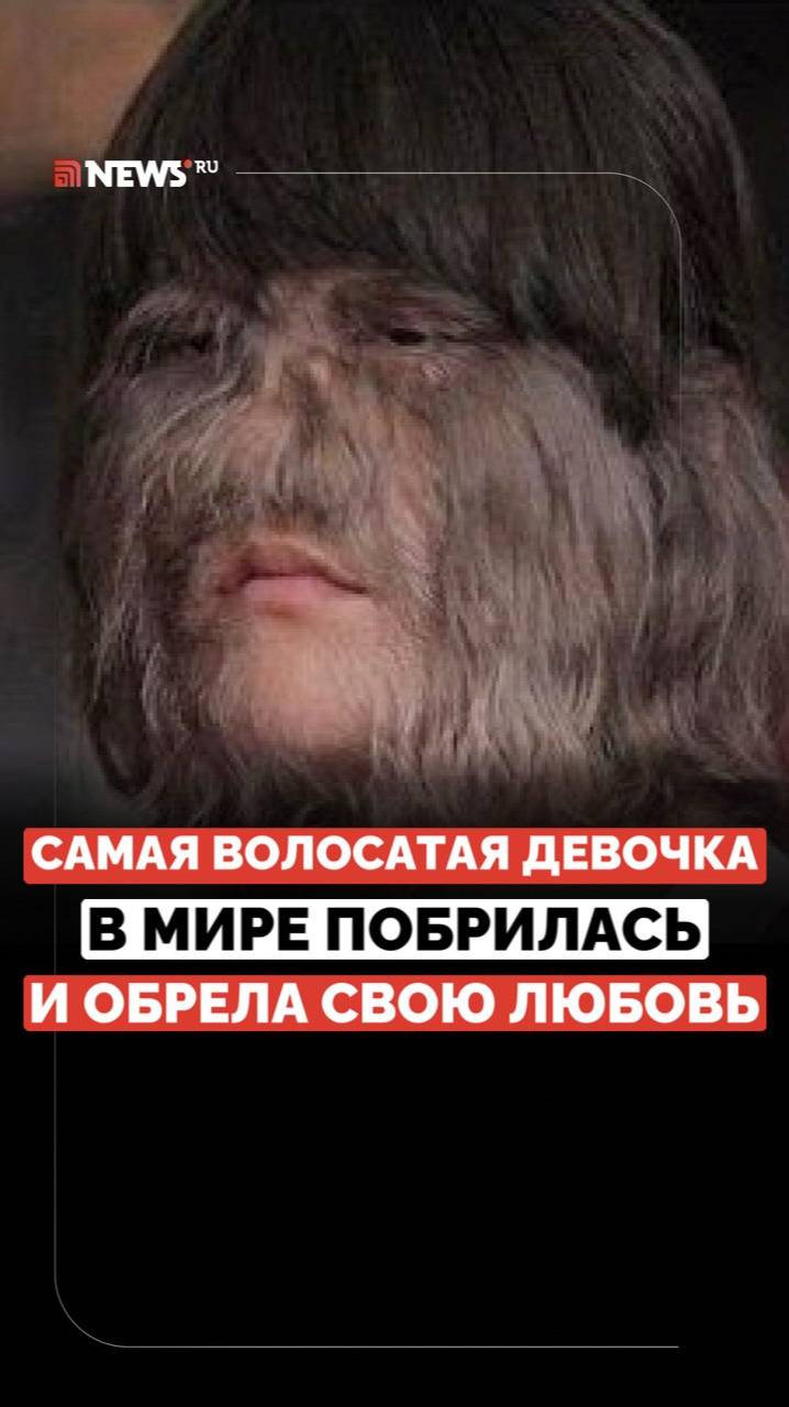 Болезнь любви не помеха. Как самая волосатая девушка в мире нашла себе пару?