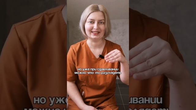 ЧТО НУЖНО ЗНАТЬ ПРО ЦЕЛЛЮЛИТ? #массаж
