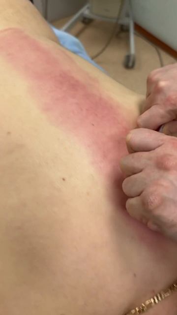 Техника для расслабления спины. Массажный скребок. Ра? смотреть онлайн