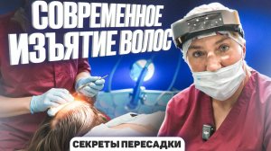 Самый современный метод изъятия волос — Shaving Line FUE Handle (Part Shaving)