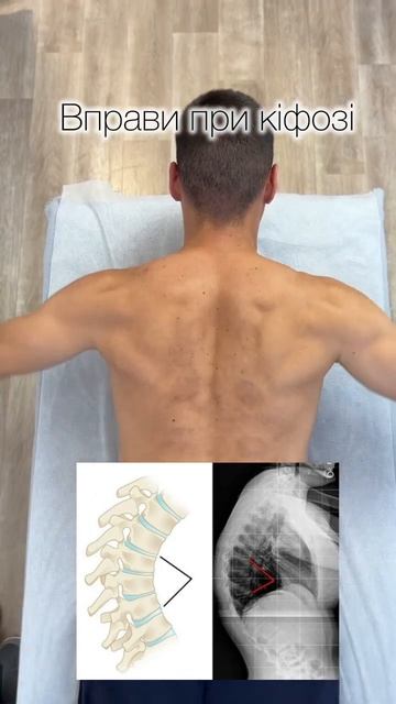 Легкі та корисні вправи для вашої спини ✅студія масаж смотреть онлайн