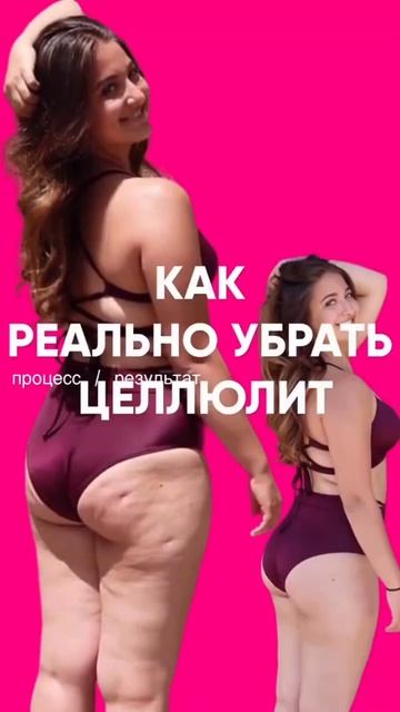 Как реально убрать целлюлит?