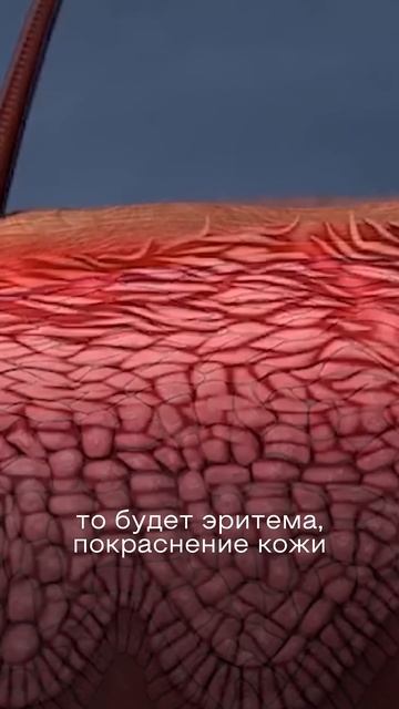 ЧЕМ ПОЛЕЗЕН МАССАЖ ГОЛОВЫ? смотреть онлайн