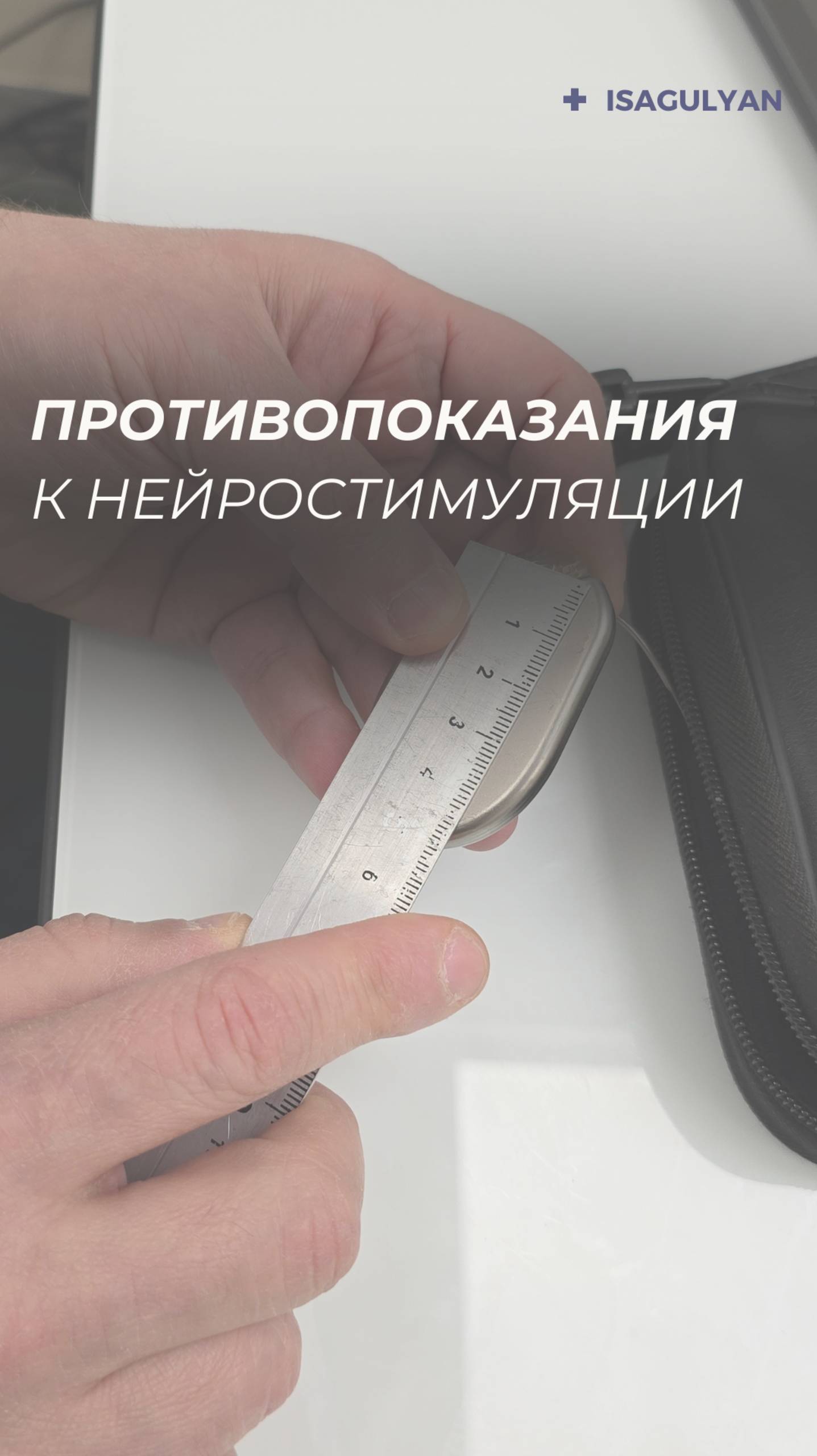 Нейростимуляция. Противопоказания