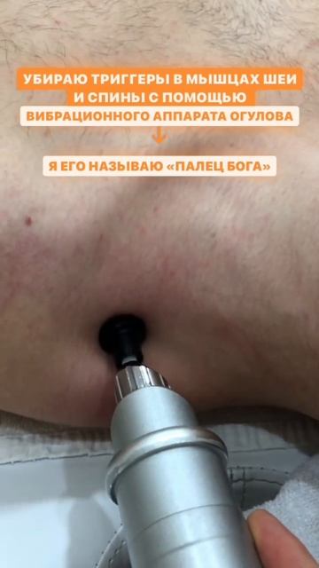 Проработка (массаж) триггерных точек в мышцах спины с ?