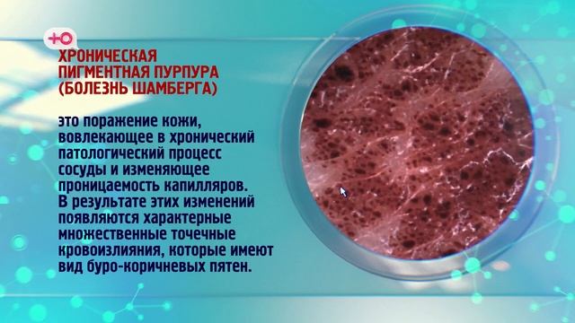 Я стесняюсь своего тела Россия Сезон 2 Выпуск 1 S02E01