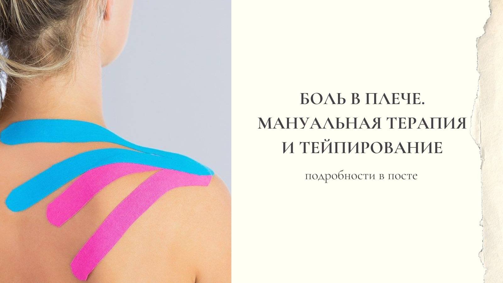 Лечение боли в плечевом суставе. Мануальная терапия и тейпирование.
