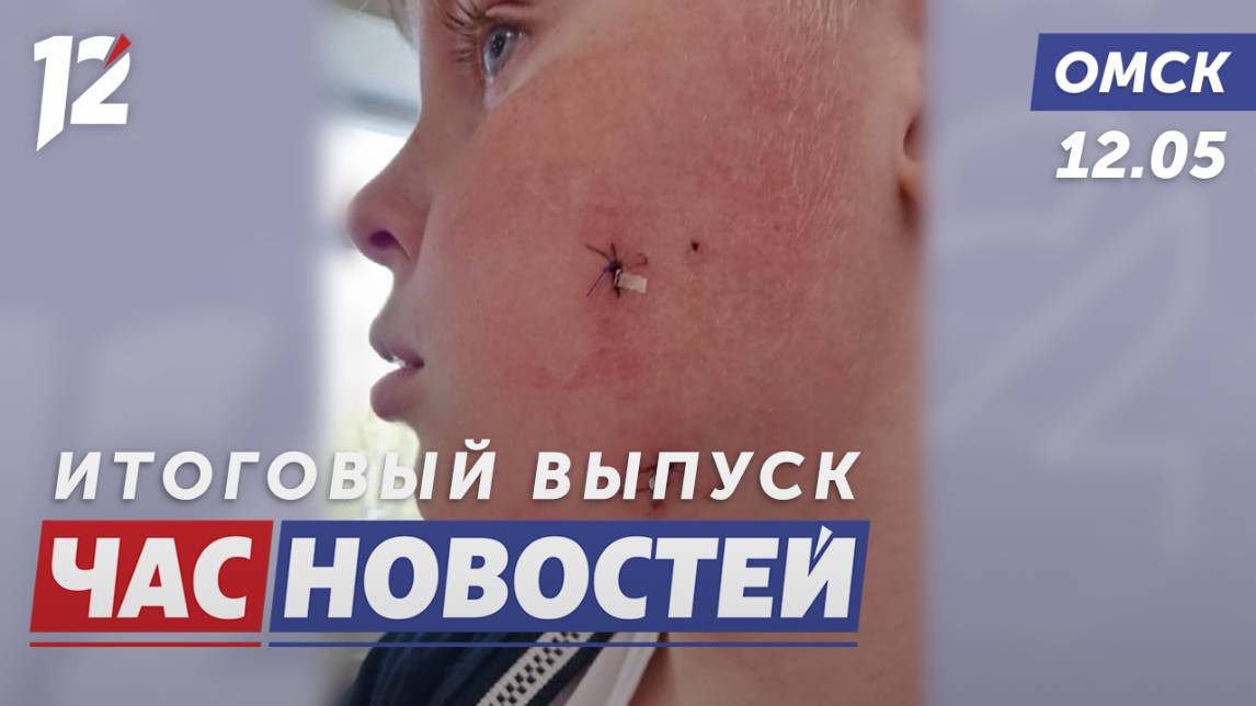 Собака напала на ребенка / Улица Ленина / Миграционный вопрос. Новости Омска