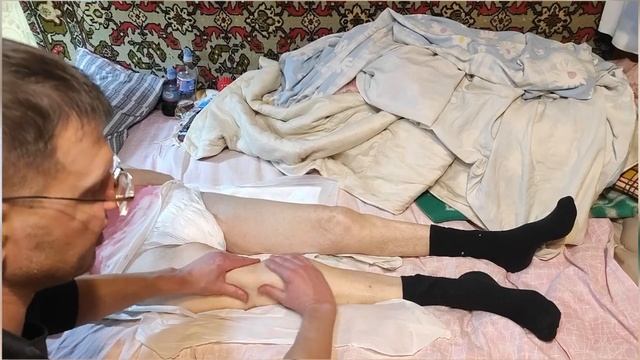 Перелом бедра у пожилых если залежались, как поднять н