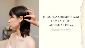 Иглоукалывание для похудения. Золотая игла. Аурикулотерапия