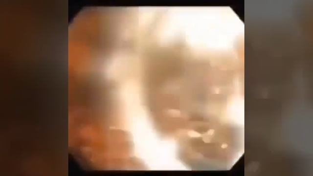 #алоэвера #здоровыйкишечник #кишечник смотреть онлайн