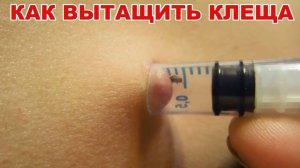 Как вытащить КЛЕЩА шприцом, ПРОСТОЙ, ЭФФЕКТИВНЫЙ способ!