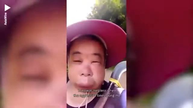 Пчелы покусали