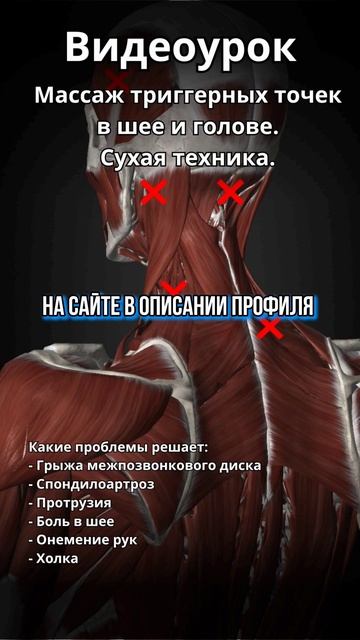 Массаж триггерных точек #массаж