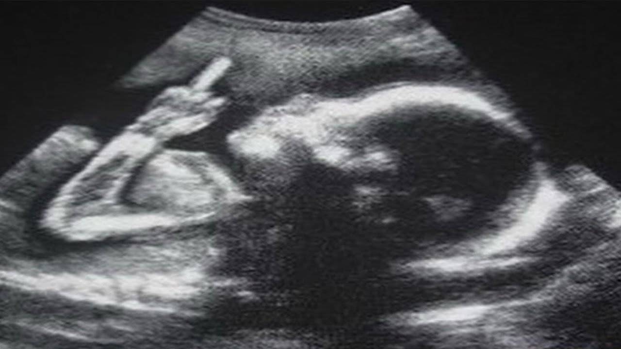 YOU LAUGH YOU GET CANCER (StreetCan)