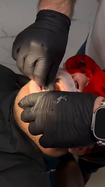 Для тех кто не хочет брекеты и хочет ровные зубы, выход смотреть онлайн