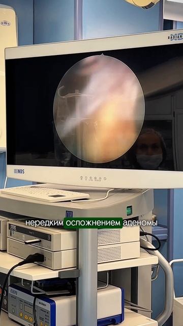 Аденома простаты и камни в мочевом пузыре смотреть онлайн