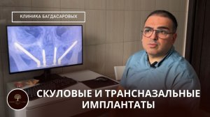 Скуловые и трансназальные имплантаты