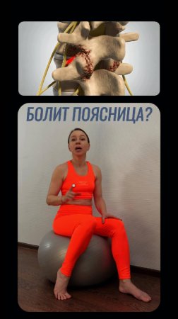 Частая причина болей в спине - фасет синдром