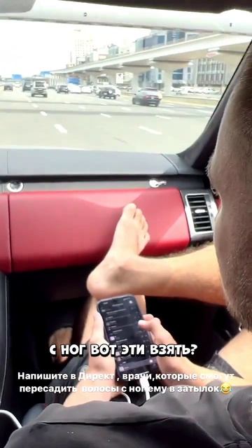 ЛИТВИН ЛЫСЕЕТ, НУЖНА ПЕРЕСАДКА С НОГ #shorts #литвин смотреть онлайн