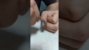 Молотком по пальцу