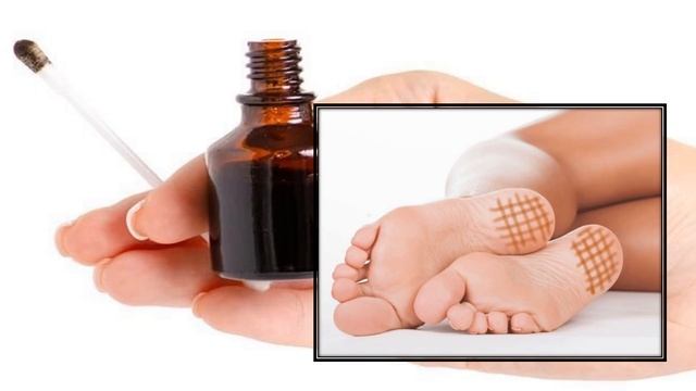 Хочешь быть здоровым? Мажь пятки на ночь йодом! смотреть онлайн