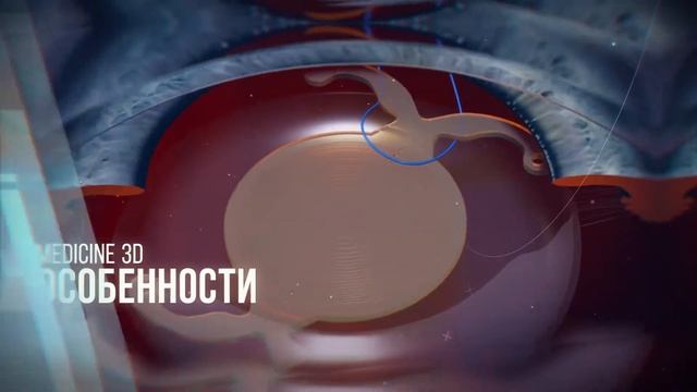 Биомедицинская визуализация. Medical animation & illustration. Biomedical visualization. @Medicine3
