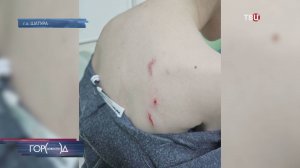 В Подмосковье возбудили дело после нападения алабая на ребенка / Город новостей на ТВЦ
