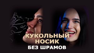 Закрытая риносептопластика: этапы, эмоции, результат по месяцам