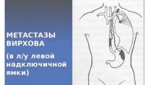 Как чувствует себя человек при раке желудка?