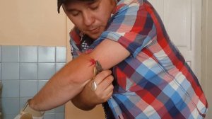 Как вынуть блесну из предплечья. Самый простой способ