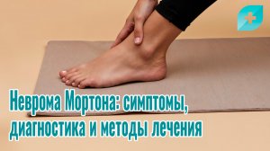 Неврома Мортона: симптомы, диагностика и методы лечения