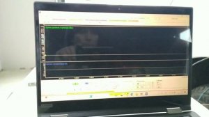 Гранта  -  ошибка P0301 -  пропуски воспламенения в 1- м цил?