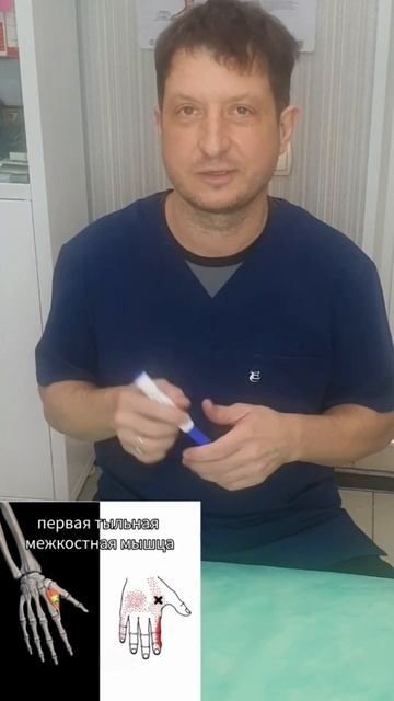 массаж триггерных точек  кисти. часть 1